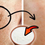 I Erased My Age Spots With a Cheap Kitchen Ingredient — Baking Soda Paste