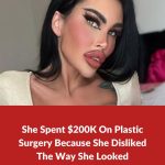 Australian “Barbie” Shows Her $71k Plastic Surgeries