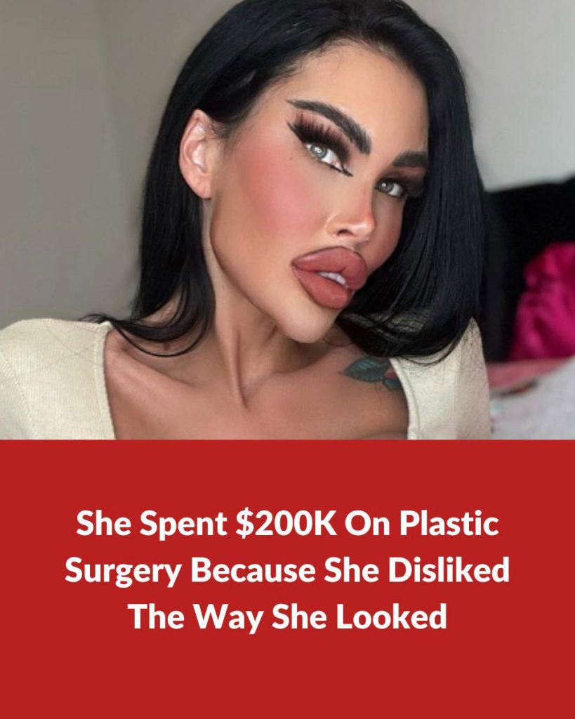 Australian “Barbie” Shows Her $71k Plastic Surgeries