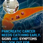 10 Signs of Pancreatic Cancer You Should Never Ignore