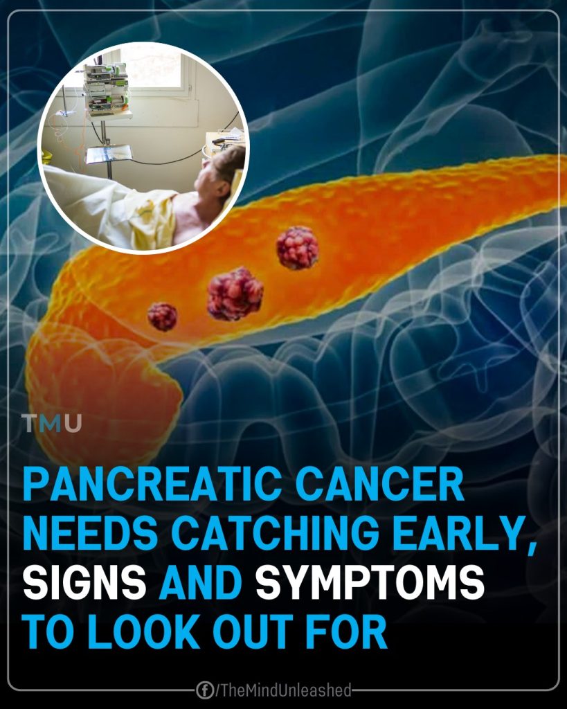 10 Signs of Pancreatic Cancer You Should Never Ignore