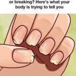 Are your nails always splitting or breaking? This is a sign your body is trying to tell you. Pay careful attention!