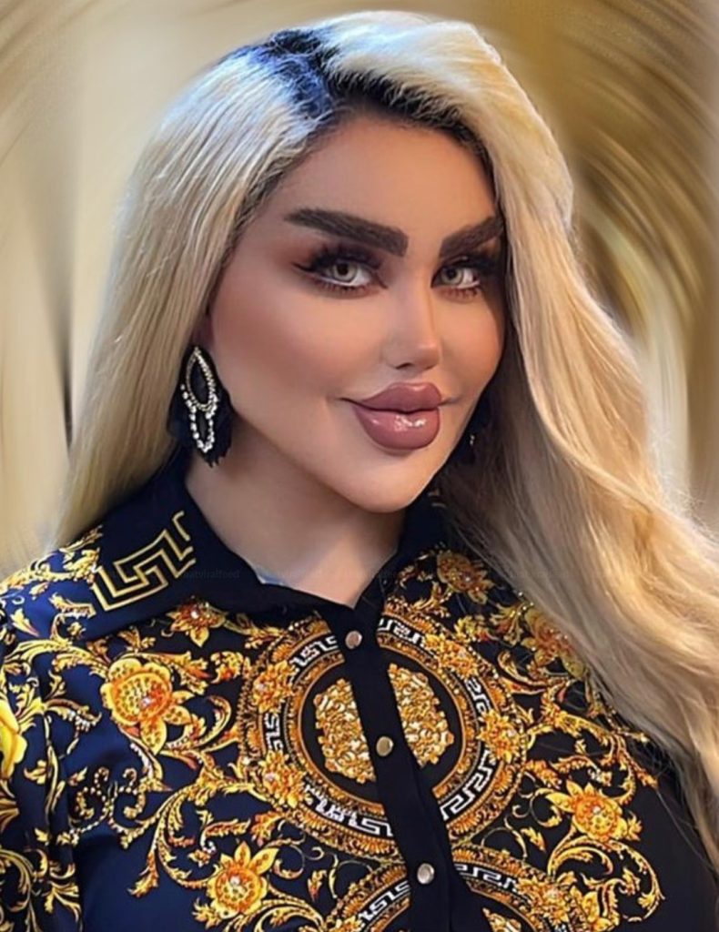 Baghdad Woman Undergoes 43 Procedures To Resemble Barbie, Faces Harsh Criticism