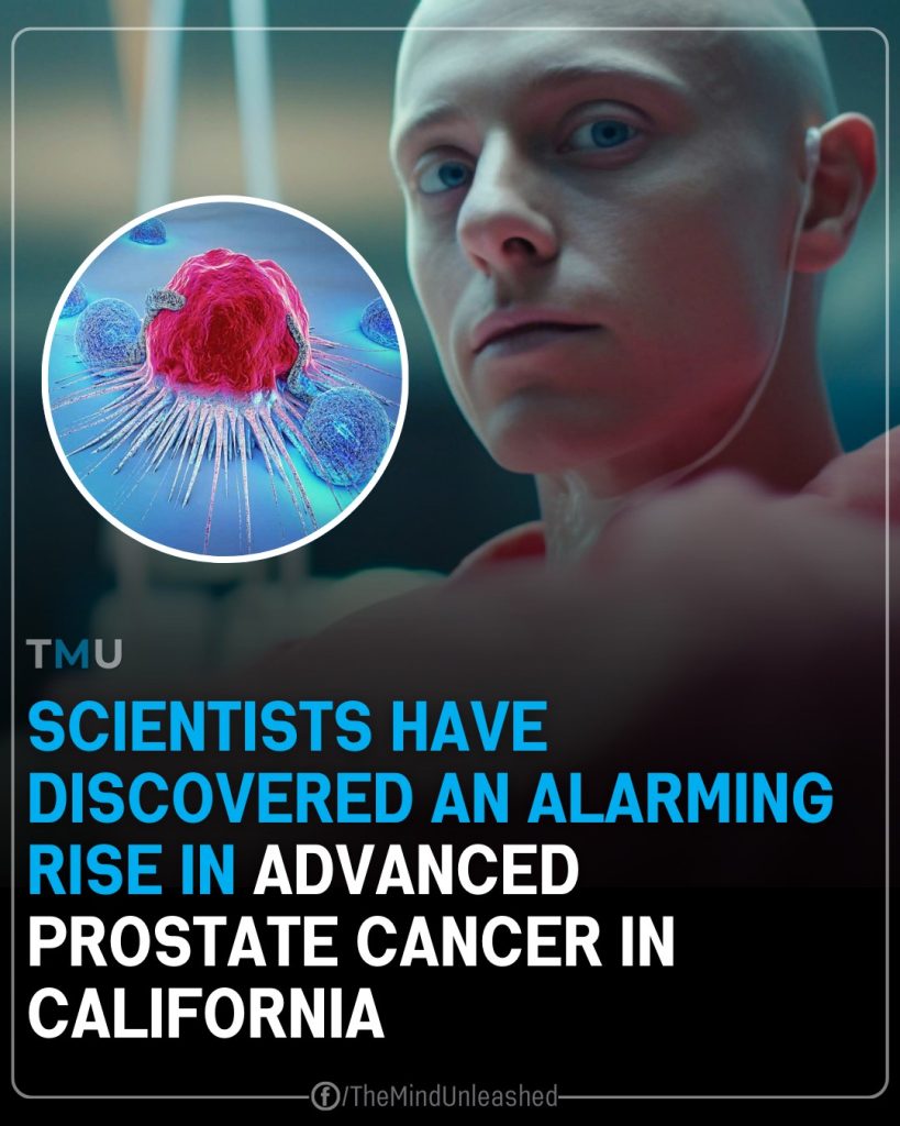 Scientists Have Discovered An Alarming Rise in Advanced Prostate Cancer in California