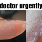 If you see these painful red bumps