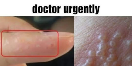 If you see these painful red bumps