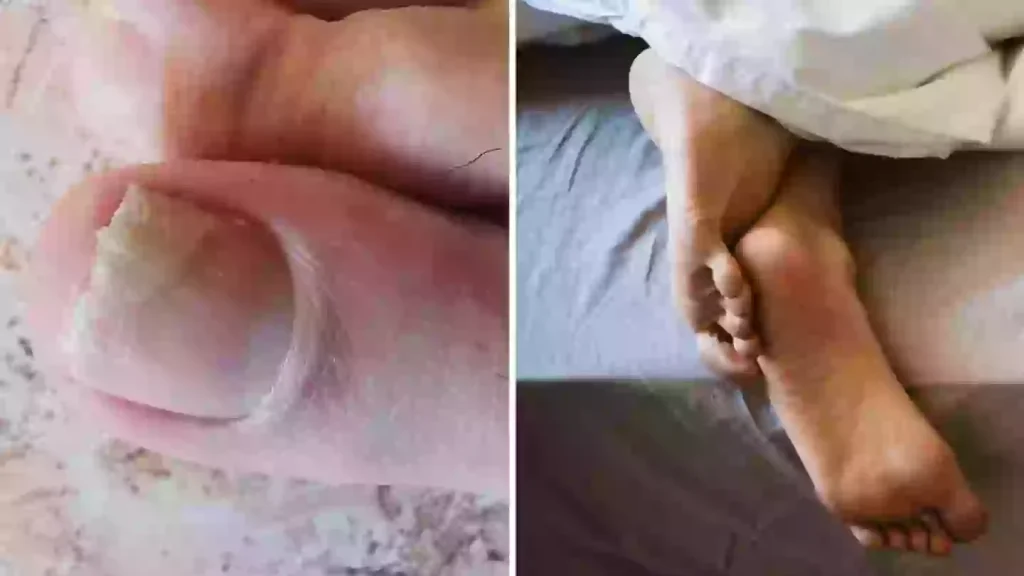 Pharmacist reveals two warning signs of silent killer that you might spot in your feet