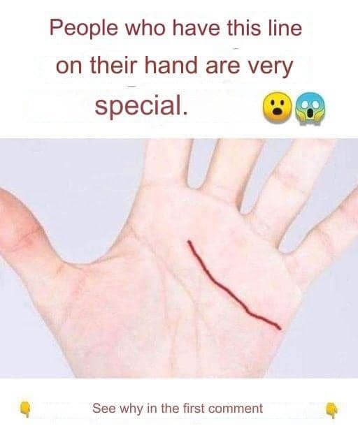 People who have this line on their hand are very special.