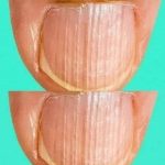 Doctor Reveals 7 Health Conditions You Can Spot By Just Checking Your Nails